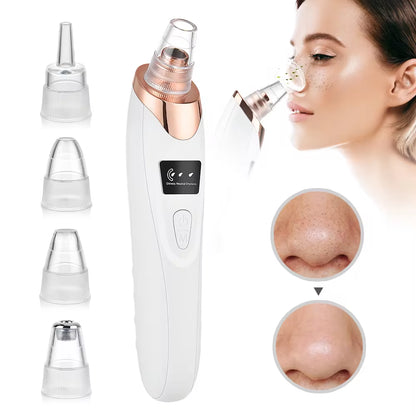 Electric Blackhead Remover with Vacuum Suction sick care tool